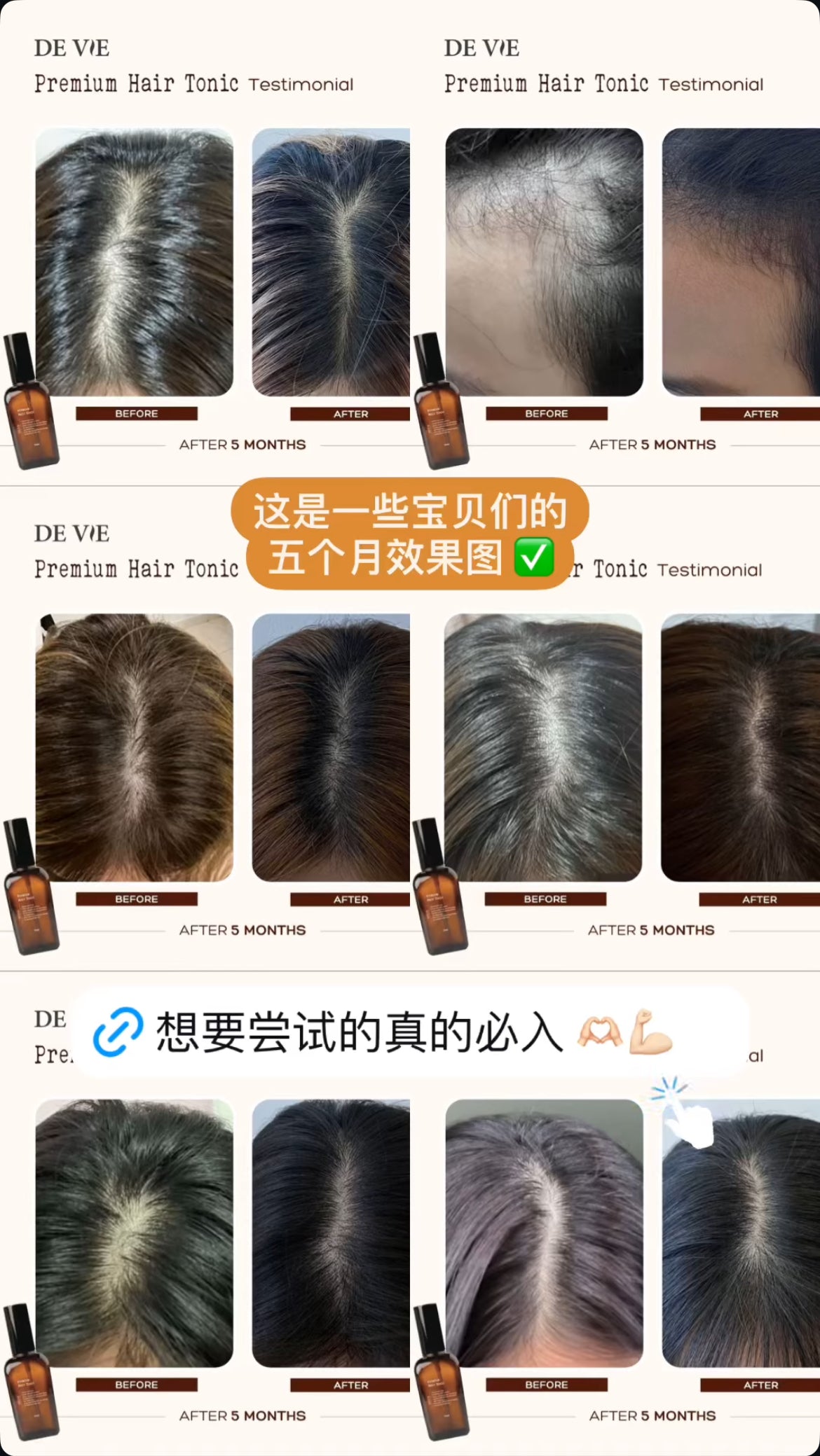 DEVIE 超强生发液效果图‼️🤎