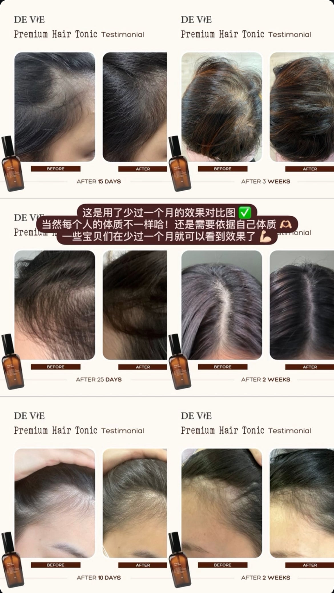 QNA ｜ 使用后真的能帮助改善头皮问题吗 ❓