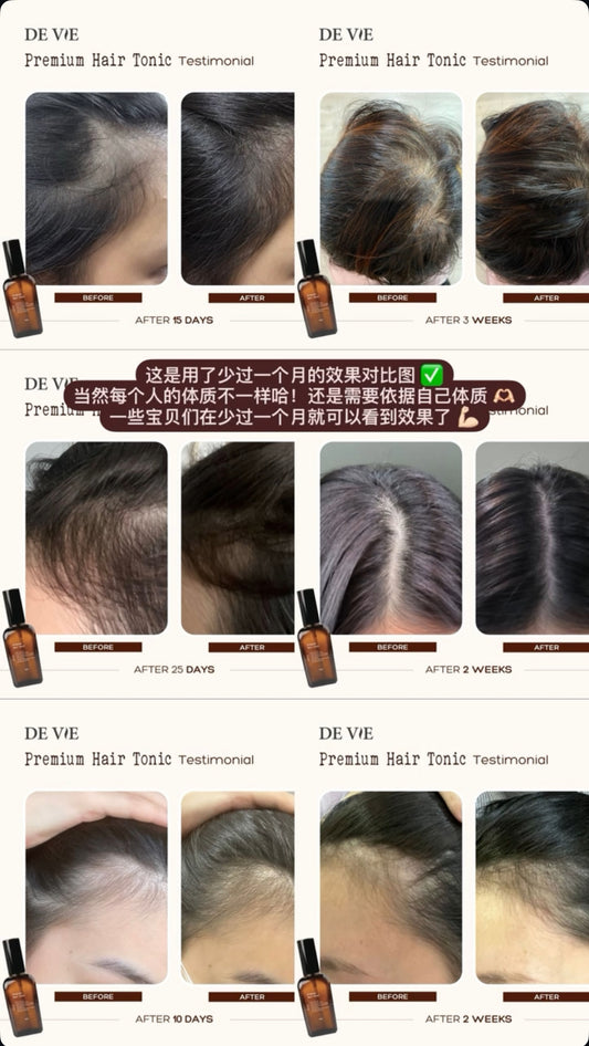 DEVIE 超强生发液效果图‼️🤎
